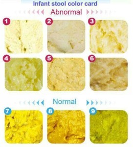 tanda feses bayi normal atau tidak normal